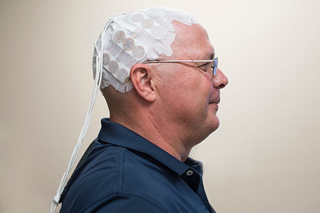 Brain Tumor Image